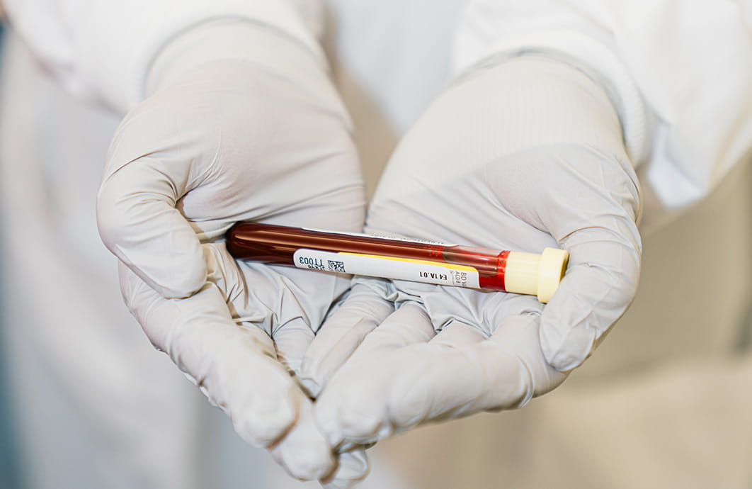 Hands with surgical gloves holding test tube filled with blood