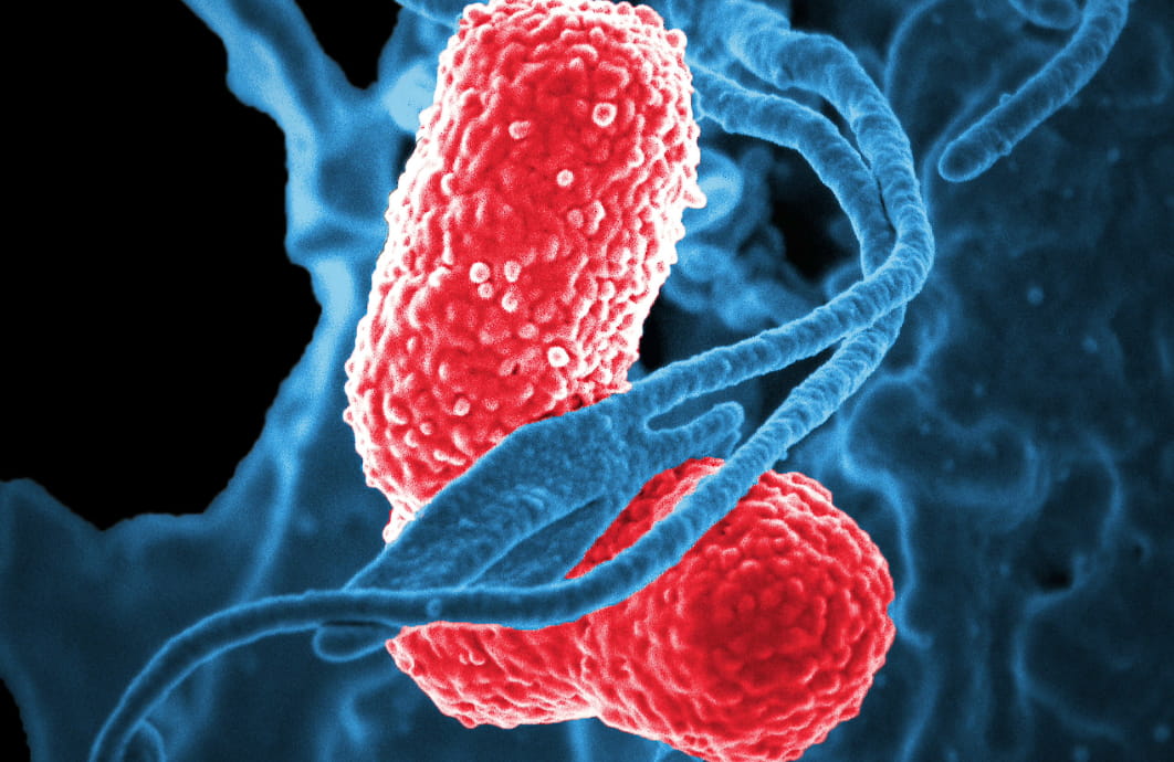 A digitally colorized scanning electron microscopic image of a blue-colored white blood cell, interacting with two pink-colored multidrug-resistant Klebsiella pneumoniae bacteria. 