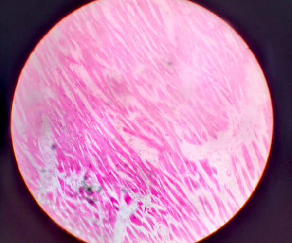 A microscopic close up of the human cardiac muscle. Image credit: Naz Amann via Wikimedia Commons