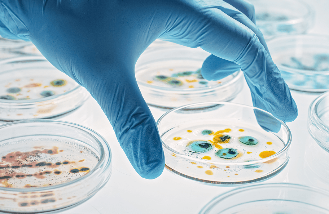 A gloved hand holds a petri dish, with other dishes in the background.
